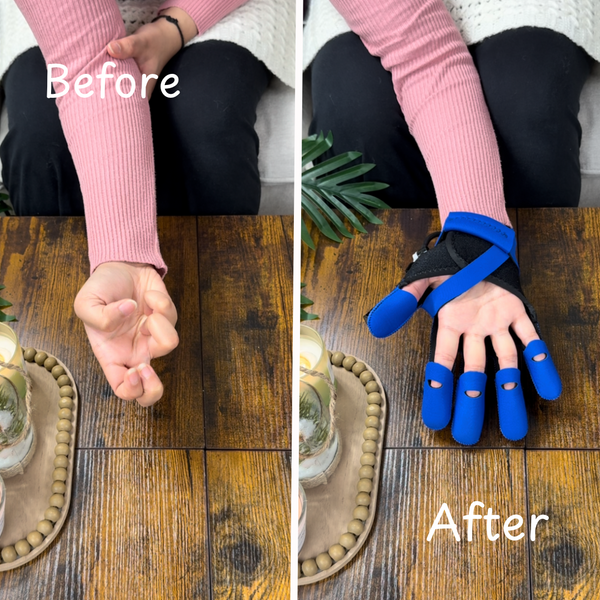 ReviveFlex: Easy Hand Recovery